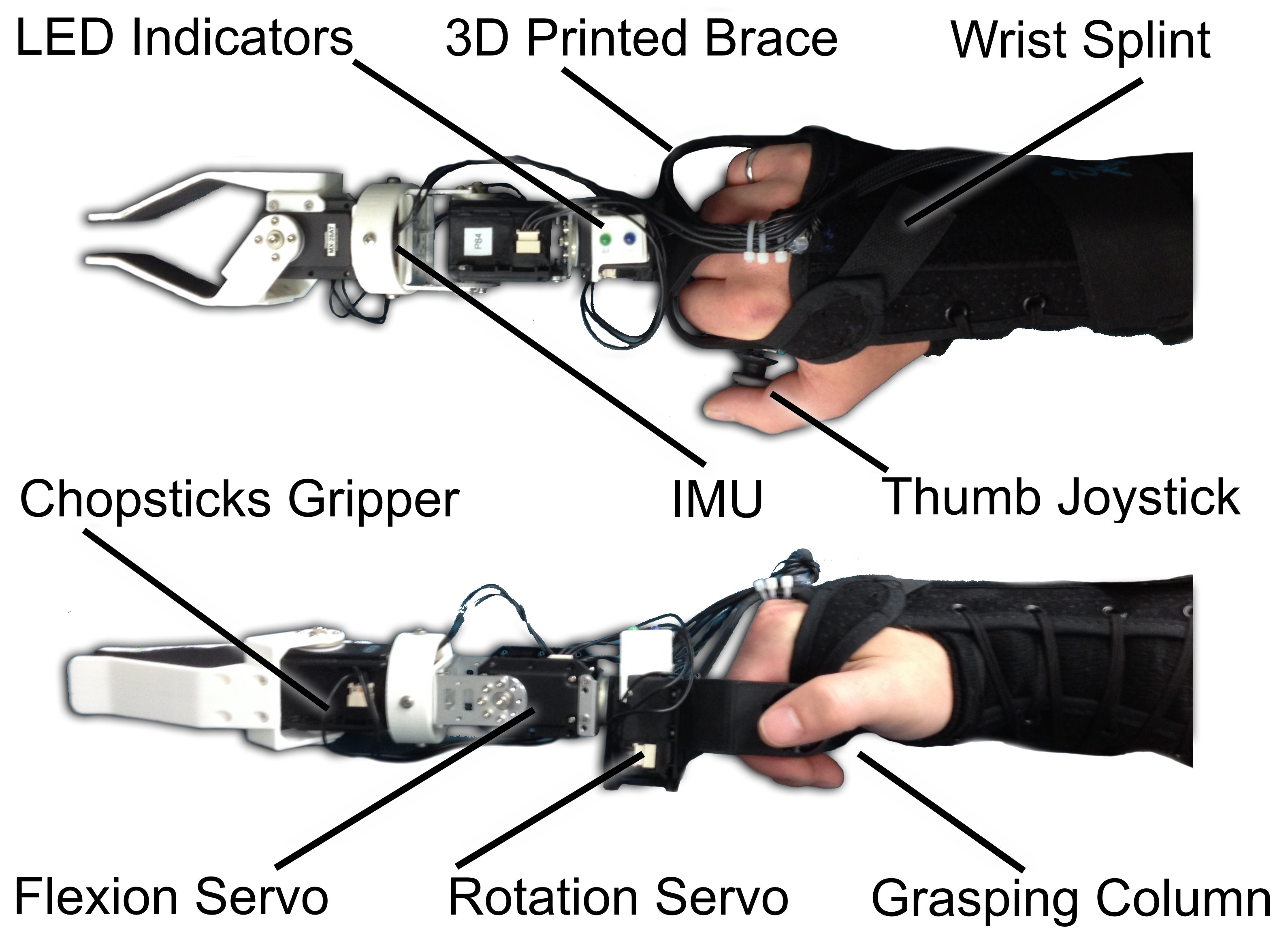 Bypass Prosthesis